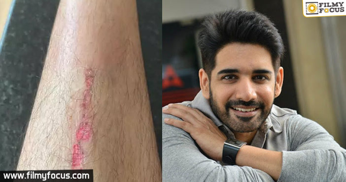 After Akhil, Sushanth suffers minor injury in his hand